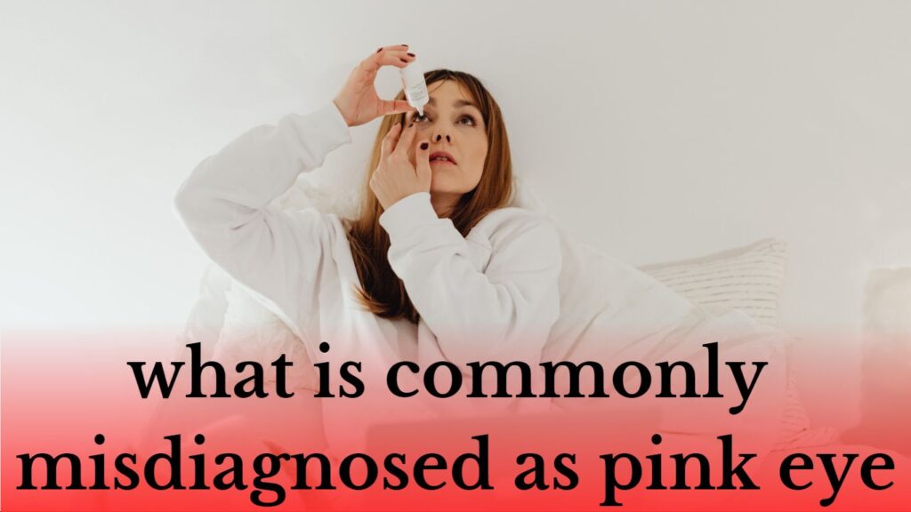 what is commonly misdiagnosed as pink eye