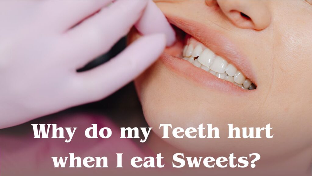 why-do-my-teeth-hurt-when-eating-sugar